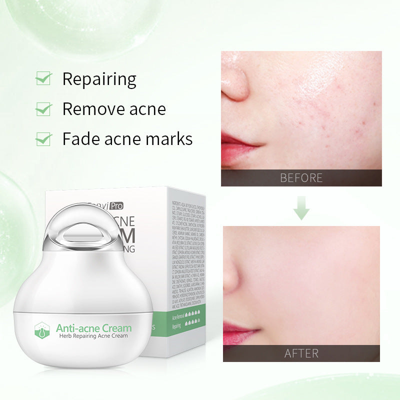 Herbal Skin Care Lotion | Moisturizing Facial Cream for General Skin | Facial Care