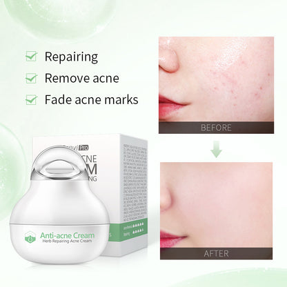 Herbal Skin Care Lotion | Moisturizing Facial Cream for General Skin | Facial Care