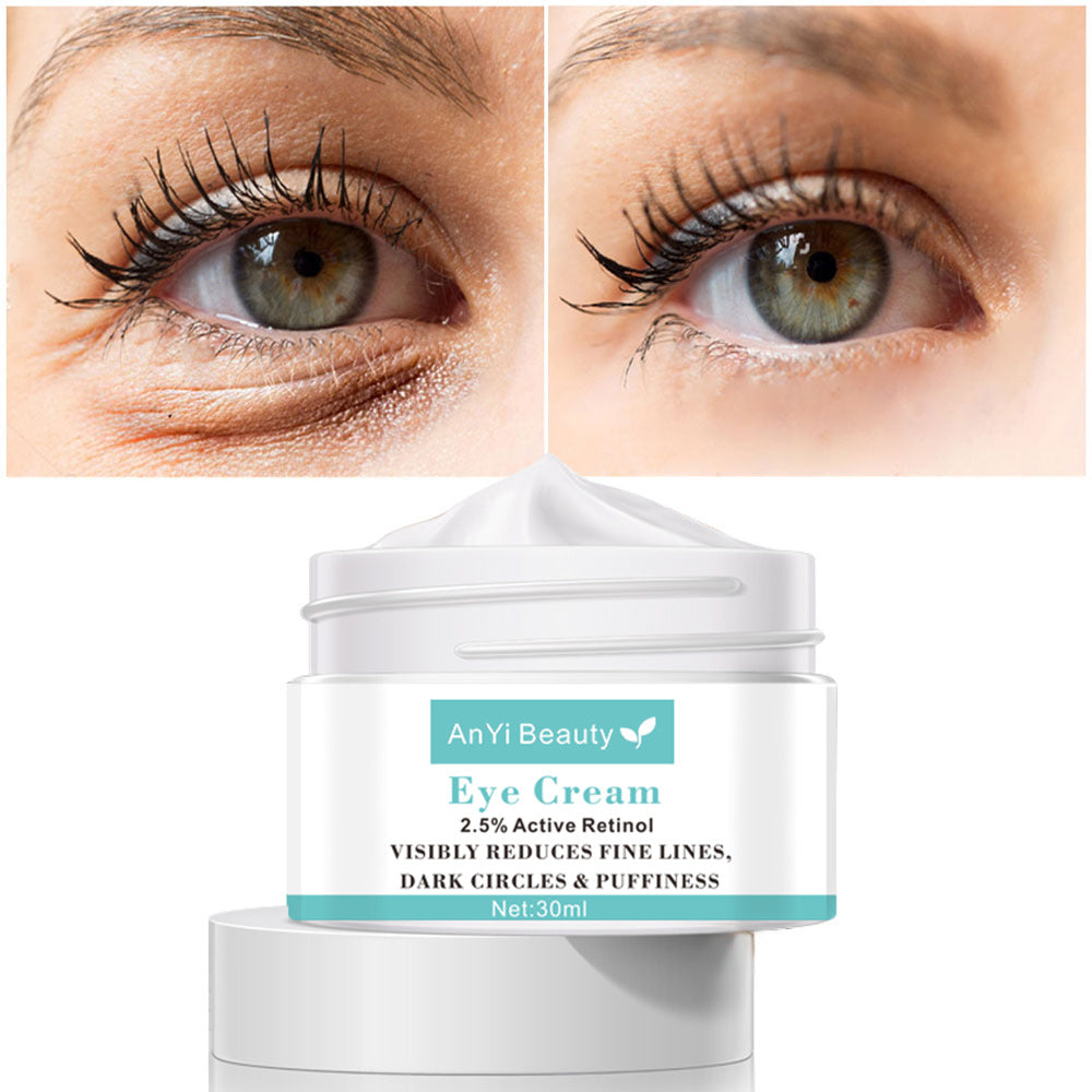 Hydrating Eye Cream 30ml – Anti-Dark Circles & Fine Lines Moisturizing Under Eye Treatment