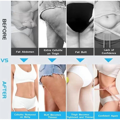 Nordicsculpt Body Sculpt, Nordic Sculpt Massage Slimming Machine Skin Tightening