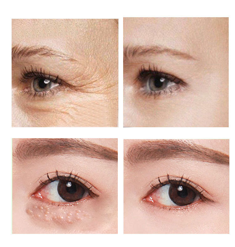 Hydrating Eye Cream 30ml – Anti-Dark Circles & Fine Lines Moisturizing Under Eye Treatment