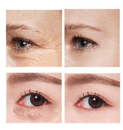 Hydrating Eye Cream 30ml – Anti-Dark Circles & Fine Lines Moisturizing Under Eye Treatment