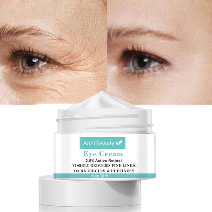 Hydrating Eye Cream 30ml – Anti-Dark Circles & Fine Lines Moisturizing Under Eye Treatment